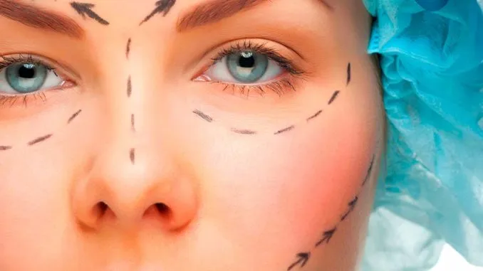 Viso con tracciati di riferimento per chirurgia plastica