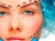 Viso con tracciati di riferimento per chirurgia plastica